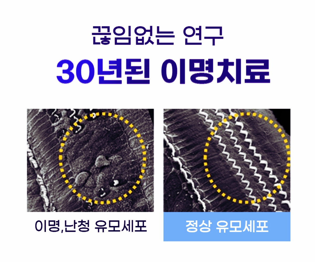 끊임없는 연구 30년된 이명치료